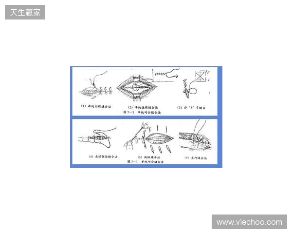 广州豹官方：杨浩眉弓伤口缝合30余针，预计5-7天后拆线